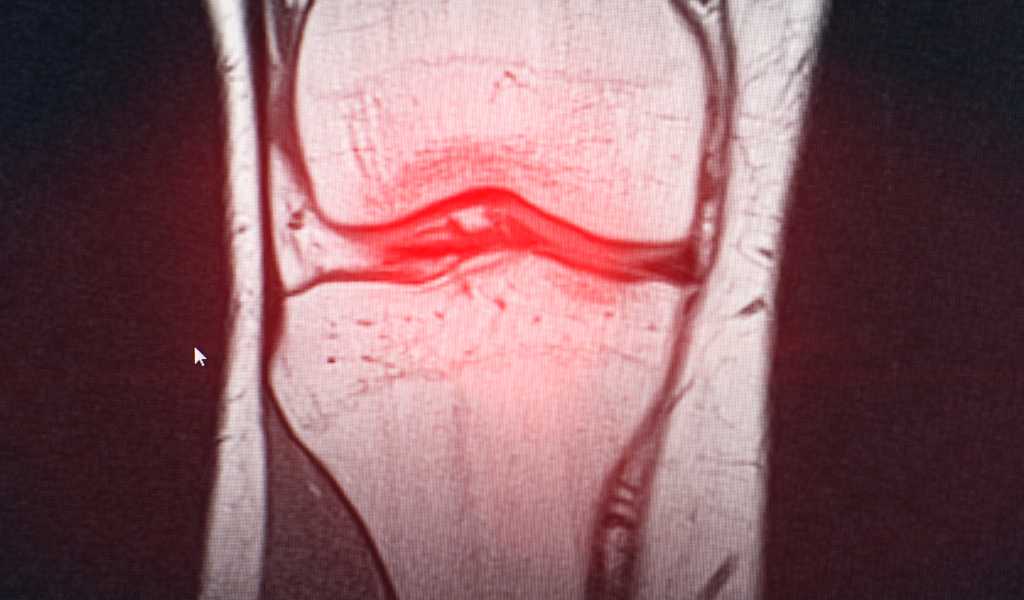 Bursitis And Tendonitis | Top Rated Chiropractor In South Burlington, Vt June 2, 2026 Chiropractic treatment for bursitis and tendonitis joint pain